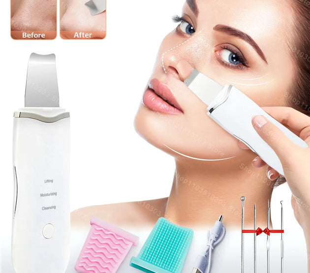 Electric Ultrasonic Skin Scrubber Vibration Face Spatula Peeling Blackhead Remover Facial Lifting Cleansing Ultrasonic Skin Care